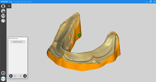 Software para odontología - RAYDENT tray - Ray - de diseño / de modelado / para tablet PC