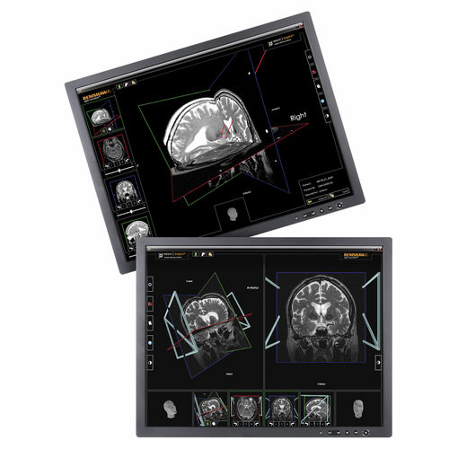 Software de planificación preoperatoria - neuroinspire™ - Renishaw - médico / para neurocirugía estereotáxica / automatizado