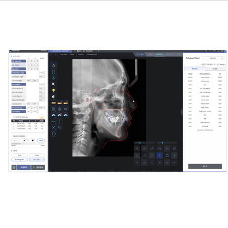 Software de análisis cefalométrico - WillCeph Pro - HDX Will - de diseño / ortodóntico
