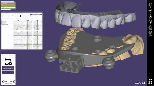 Software de diseño - exocad  - smart optics Sensortechnik GmbH   - de CAD / para odontología / Windows