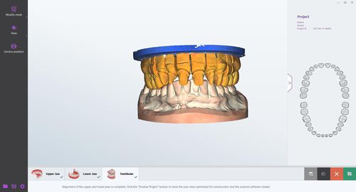 Software de laboratorio dental - smart optics Sensortechnik GmbH   - de gestión / visualizador / de diseño