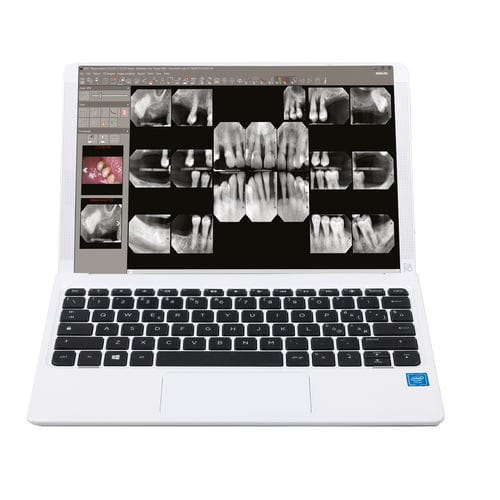 Software para odontología - iRYS - Stern Weber - de gestión / de control / visualizador