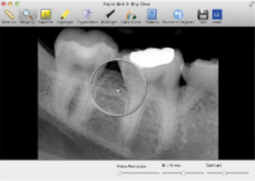 Software de gestión de datos - SuniMac - Suni Medical Imaging - de captura de imágenes / para imagen dental