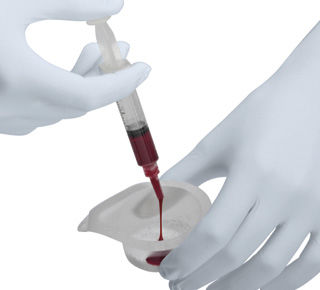 Sustituto óseo sintético - Ceros® TCP  - Thommen Medical AG   - para cirugía ortopédica / pasta