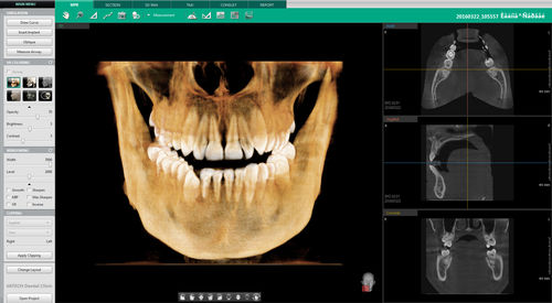 Software para odontología - Ez3D-i™ - VATECH Networks - para imagen dental / de análisis / de diagnóstico