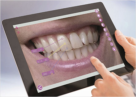 Software de visualización - mobileAssist - VITA Zahnfabrik H. Rauter GmbH & Co.KG   - de tratamiento / de simulación / de planificación