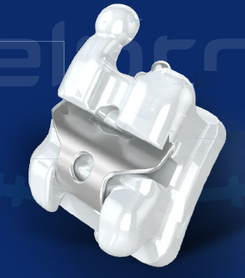 Bracket autoligante - SELPRO A - WORLD BIO TECH   - de cerámica / redondo / estrecho