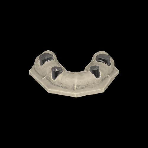 Módulo de software de CAD - Telescopic crowns - Zirkonzahn - de creación de prótesis dentales / FAO / de laboratorio dental