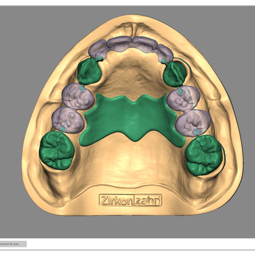 Software de importación - Partial-Planner - Zirkonzahn - de simulación en 3D / de creación de prótesis dentales / para restauración dental