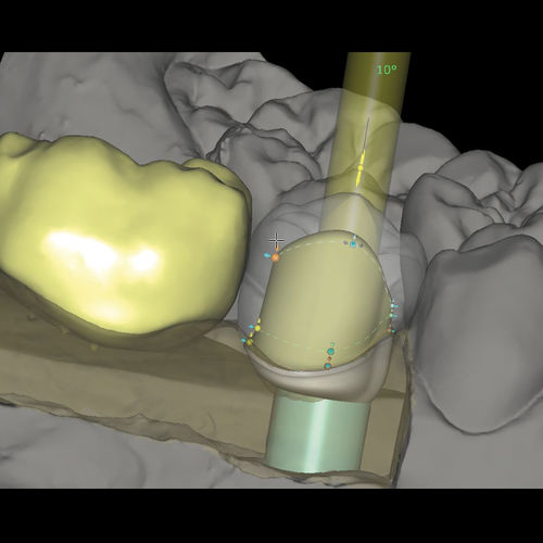 Módulo de software de creación de prótesis dentales - CAD/CAM Abutments - Zirkonzahn - de fabricación / de laboratorio dental