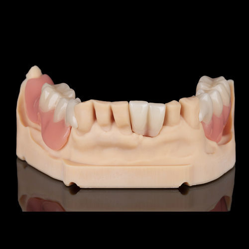 Prótesis dental de resina - Flexmon Partials - Zirkonzahn - a medida / amovible