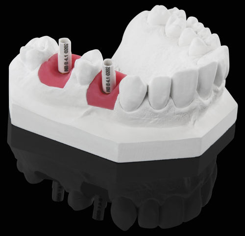 Cuerpo de exploración blanco - White Scanmarker - Zirkonzahn - intraoral