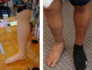 Prótesis estética esterna para pierna - Boston Orthotics + Prosthetics - para adulto