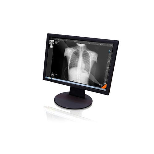 Software de visualización - Xview4 - GEMSS Medical Systems - de radiología / para tablet PC