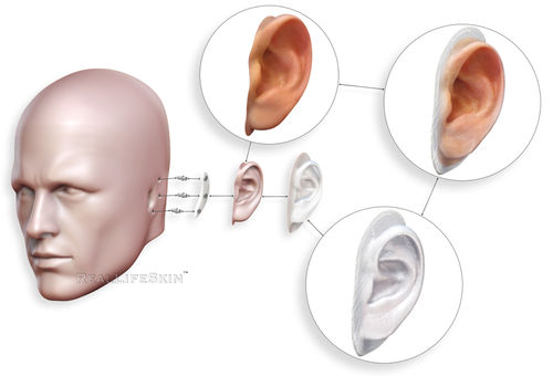 Prótesis estética esterna auricular - RealLifeSkin™ - RealLifeSkin - para adulto