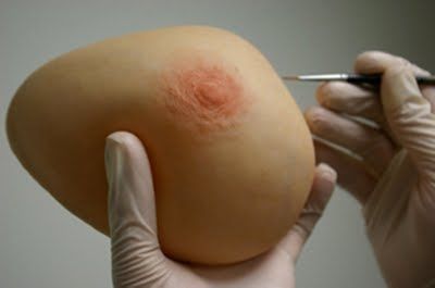 Prótesis estética esterna mamaria - The Anaplastology Clinic - para adulto
