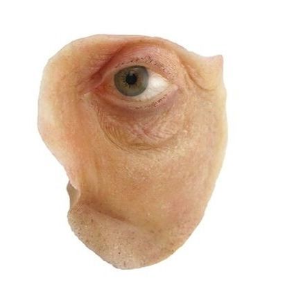 Prótesis estética esterna orbital - The Anaplastology Clinic - para adulto