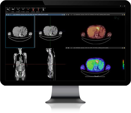 PACS para imágenes médicas - INFINITT PACS - Infinitt Healthcare ...