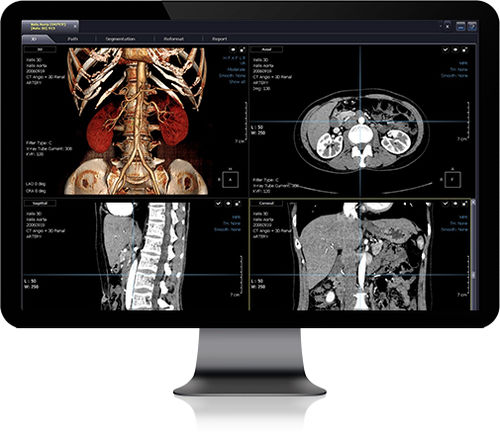 Software de simulación de implante dental - Xelis - Infinitt Healthcare - para informes / de visualización / de diagnóstico