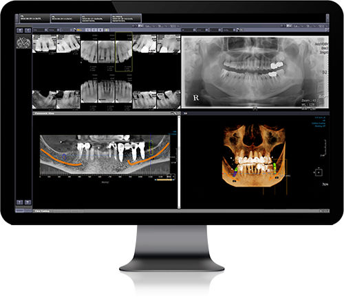 PACS procesos basados en la web - Infinitt Healthcare - médico