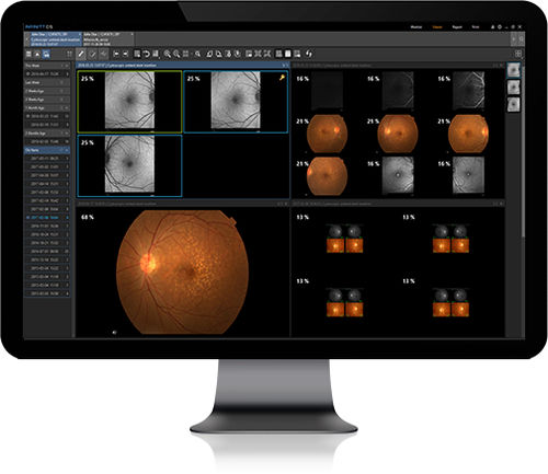 Software médico - Infinitt Healthcare - para historias clínicas / para oftalmología / de gestión