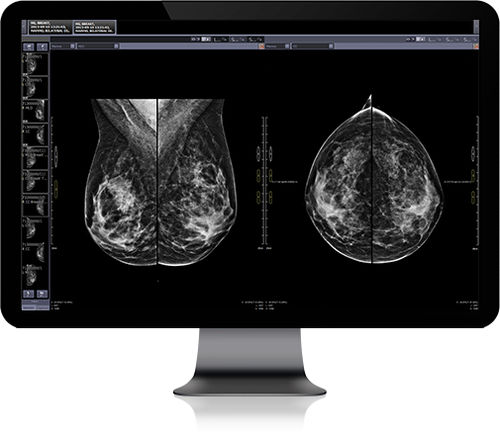 Software de diagnóstico - Infinitt Healthcare - de CAD / médico / para PACS