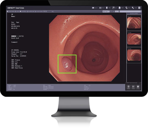 Software de análisis de imágenes - Smart Endo - Infinitt Healthcare - de diagnóstico / médico