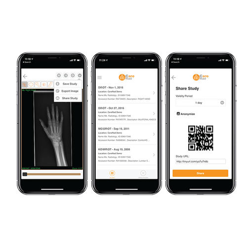 Software de intercambio - CareRad - PaxeraHealth Corp - de análisis de imágenes / de gestión / de control