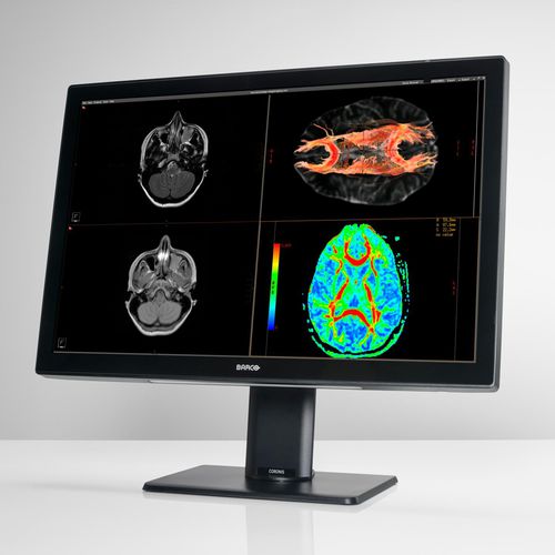 monitor de diagnóstico - Barco