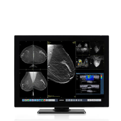 Monitor médico - Coronis OneLook - Barco - de radiología / mamográfico / a distancia