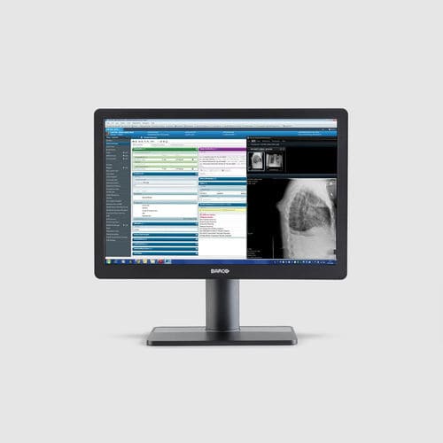Monitor médico - MDRC‑2424 - Barco - de radiología / 1920x1200 / 24"