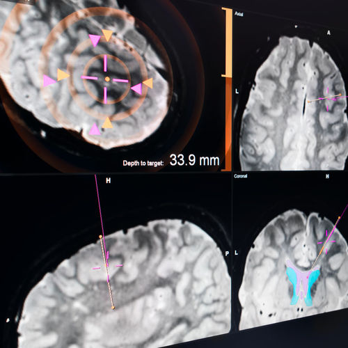 Software de hospital - EM - Brainlab - para neurocirugía / de control / de calibración