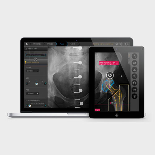 Software de análisis - TraumaCad® - Brainlab - visualizador / de planificación preoperatoria / de calibración