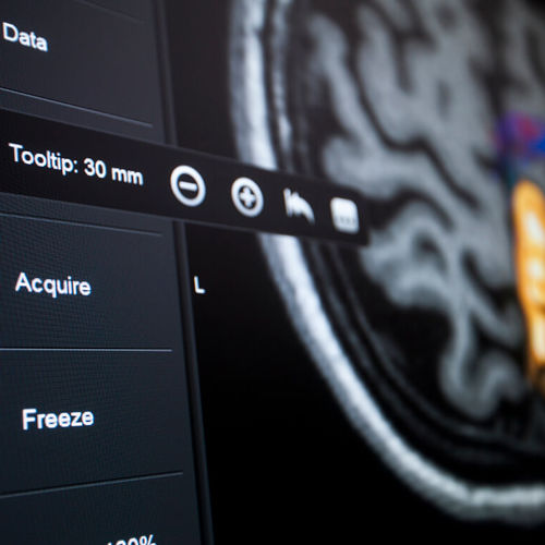 Software de hospital - Brainlab - para neurocirugía / de control / de visualización