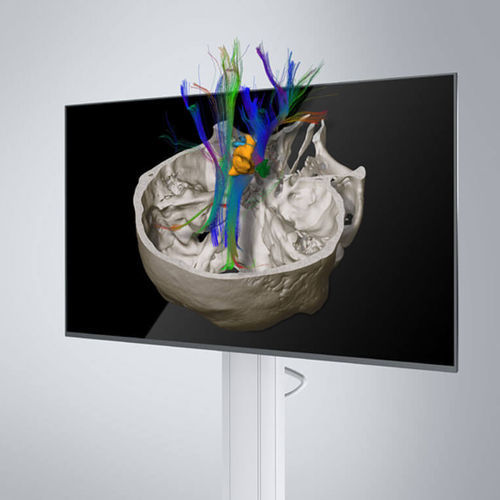 Módulo de software clínico - Brainlab - para neurocirugía / de hospital / de visualización DICOM