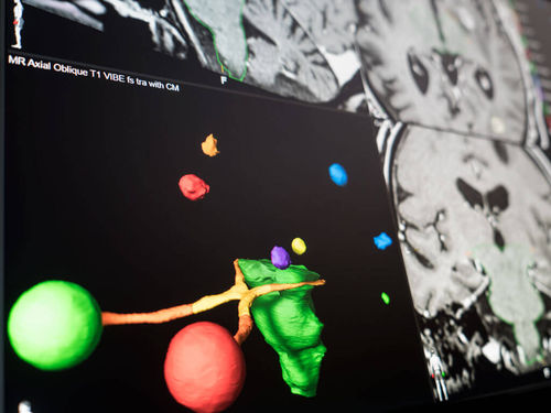 Software de visualización - Brainlab - de planificación preoperatoria / de planificación de tratamiento / de tratamiento