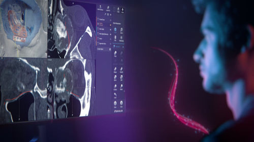 Software médico - Brainlab - para cirugía craneal / para cirugía / para cirugía asistida por robot