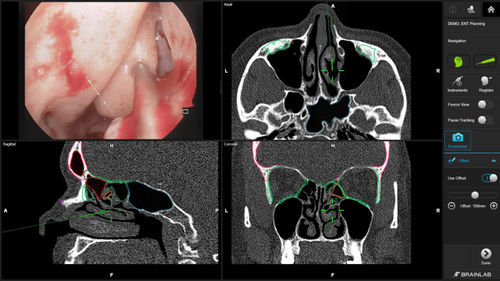 Aplicación web médica - Brainlab - de ORL / quirúrgica / de control