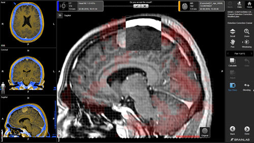 Software médico - Brainlab - neurológico / de planificación / de planificación de tratamiento