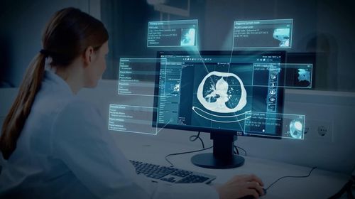Software de tratamiento - Brainlab - con sistema de seguimiento / médico / de pulmón