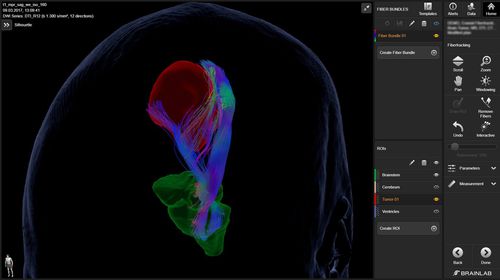 Software médico - Elements  - Brainlab - para neurocirugía / neurológico / de análisis