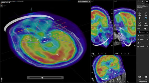 Software médico - Brainlab - clínico / para cirugía / quirúrgico