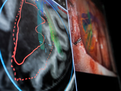 Software de neuronavegación - Brainlab - de oculometría / de hospital / para cirugía