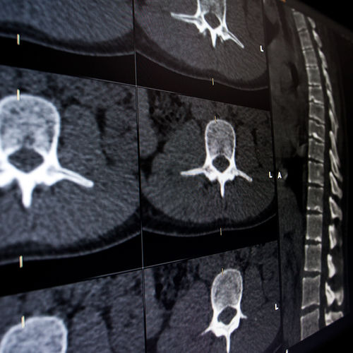 Software médico - Brainlab - para neurocirugía del raquis / neurológico / de visualización