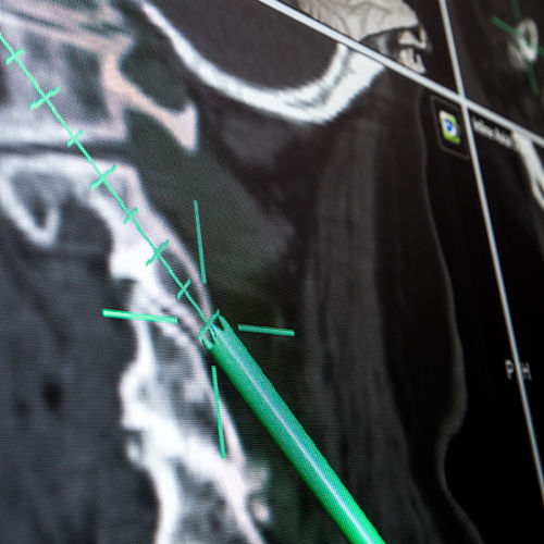 Software de navegación quirúrgica - Brainlab - médico / de hospital / TDM