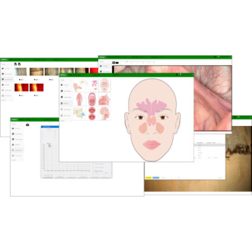Software de tratamiento - IVM - Entermed - médico / de hospital / para endoscopia