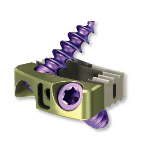 Caja intersomática cervical - 8.6970.505 - ChM - vía anterior / de titanio / de PEEK