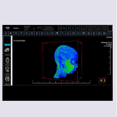 PACS para imágenes médicas - Allengers Medical Systems