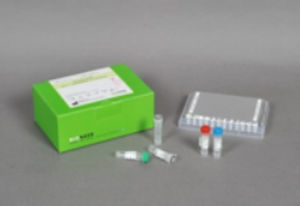 Kit de prueba de SIDA - AccuPower® - Bioneer Corporation - para enfermermedades infecciosas / de VIH / de sangre