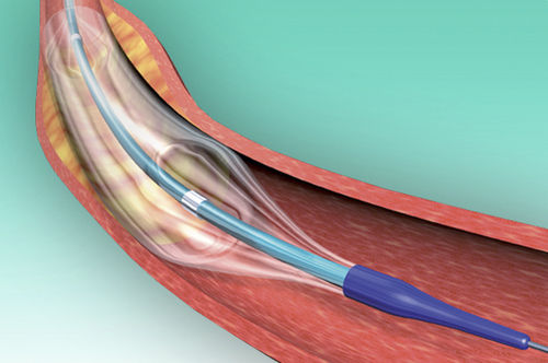 Catéter ACTP - POWERLINE™ - Biosensors International - coronario / con balón / con revestimiento hidrófilo